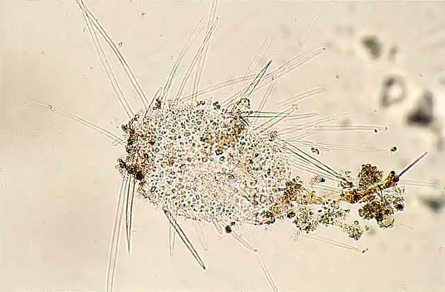 Unknown plankton species.